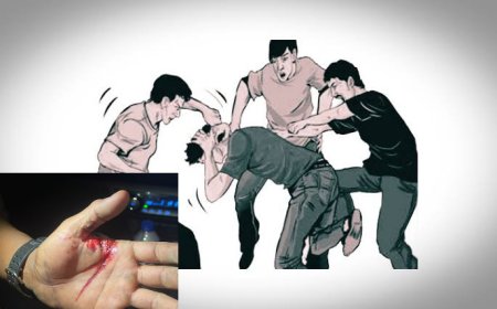 Dugaan Kasus Penganiayaan oleh Karyawan Bus ALS, Korban Tuntut Proses Hukum Tegas